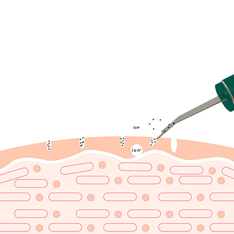 Illustration of a needle injecting a substance into skin tissue with labeled components.