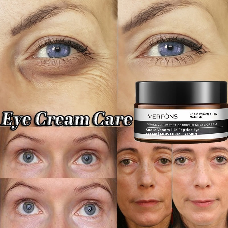 Before and after effects of eye cream on a person's eyes with a Verfons eye cream container.
