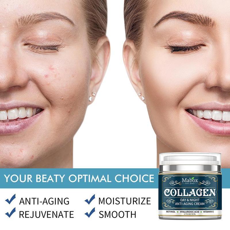 Before and after comparison of a woman's face with Mabox Collagen cream.