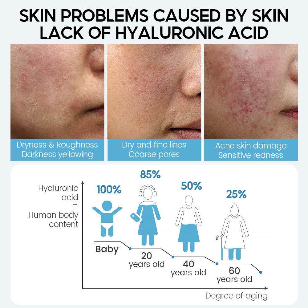 Infographic showing skin problems caused by hyaluronic acid deficiency and its decrease with age.